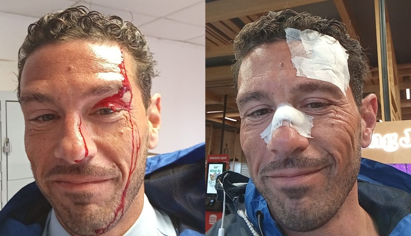 Violento ataque a un chofer: le dieron cinco puntos tras ser golpeado con un alicate | Córdoba