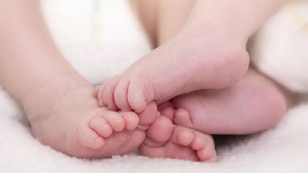 Separaron a los siameses Gianluca y Santino: procedimiento inédito en Argentina | Actualidad