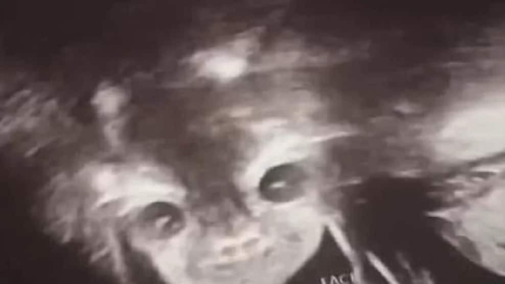 Se hizo una ecografía y dice que su hija "se parece al diablo" | Redes