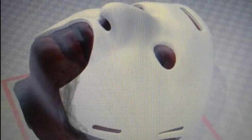 Cirujanos argentinos crearon una máscara 3D para reconstrucción facial | Actualidad