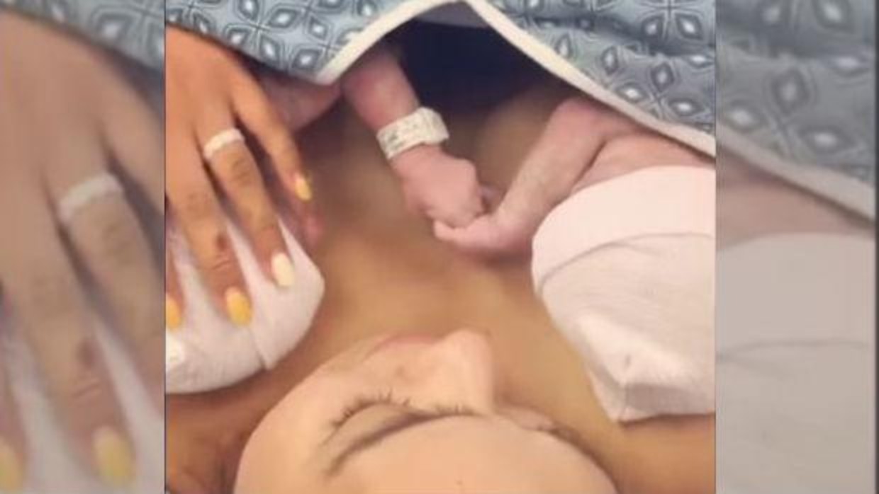 Video conmovedor: las gemelas que nacieron agarradas de la mano | Curiosidades