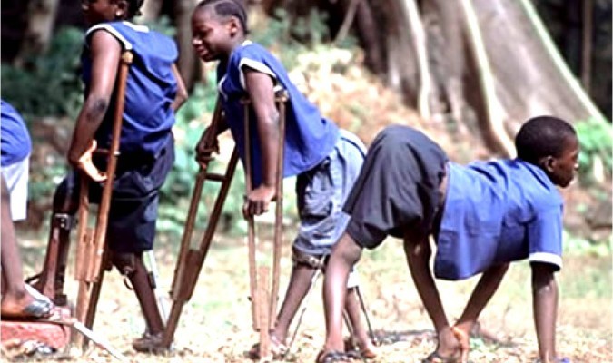 Día Mundial de Lucha contra la Poliomielitis: erradicada de América, aún afecta a niños en Asia | Actualidad