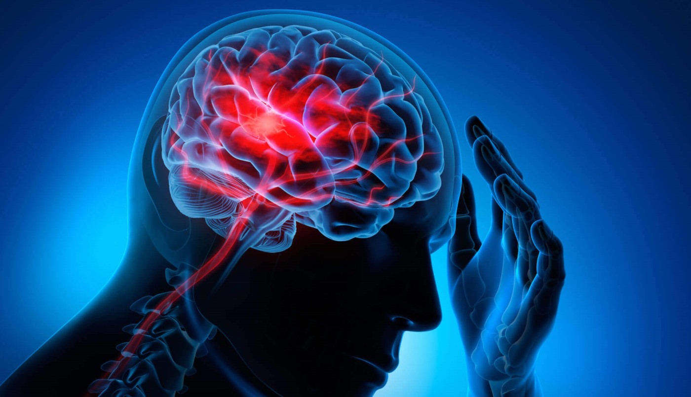 Día Mundial del ACV: síntomas, tratamiento y recuperación | Actualidad