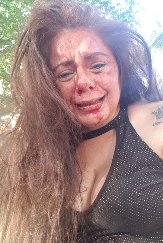 Santiago del Estero: un policía golpeó brutalmente a su novia a la salida de un boliche | Actualidad