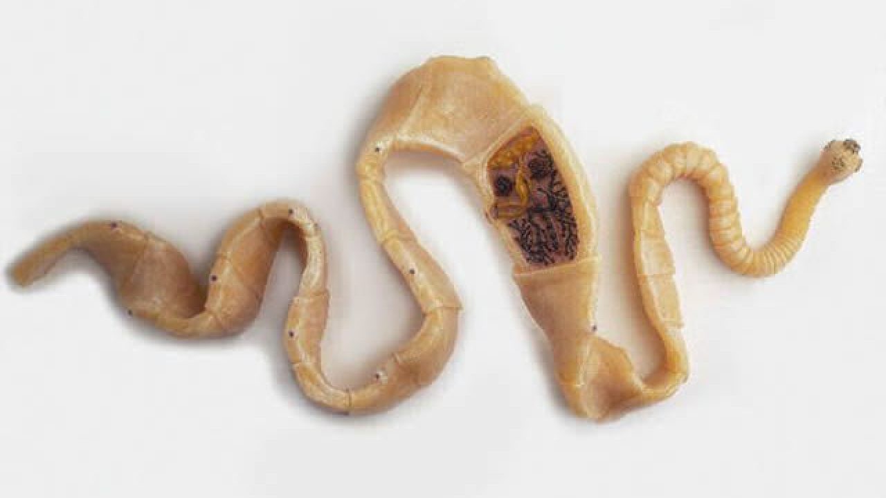 Fue al hospital por un dolor de cabeza y le descubrieron 700 "lombrices solitarias" en el cuerpo | Internacionales