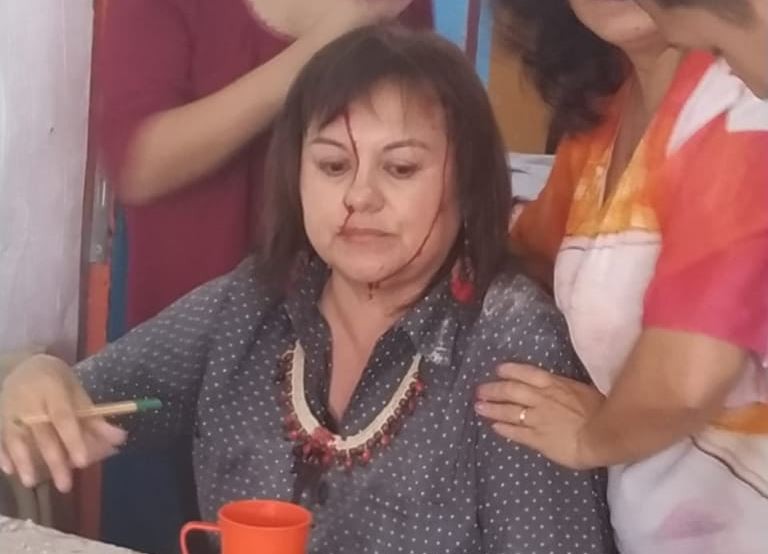 Buenos Aires: cayó la mampostería del techo de una escuela sobre una docente que daba clases | Actualidad