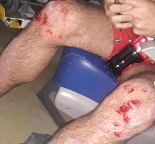 Buenos Aires: salvaje ataque homofóbico a una pareja en Villa Urquiza | Actualidad