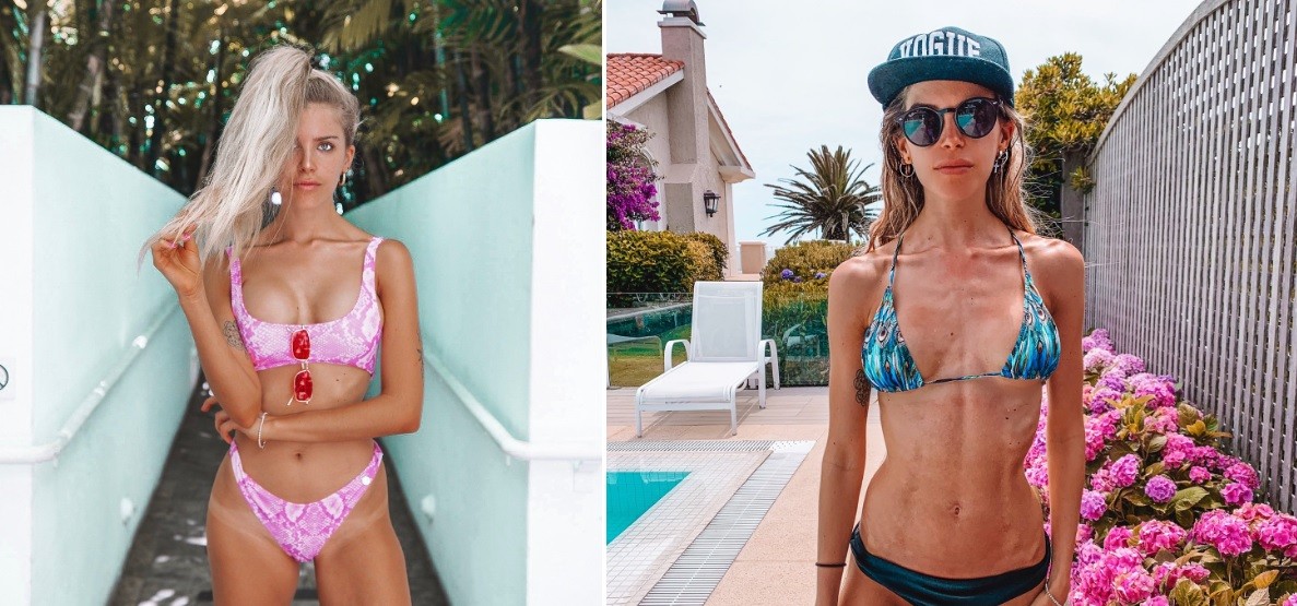 Polémica: modelo influencer compartió una foto de su extrema delgadez y salió a defenderse | Espectáculos