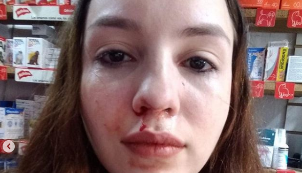 VIDEO: ataque de furia de la dueña de un gato en una veterinaria | Actualidad