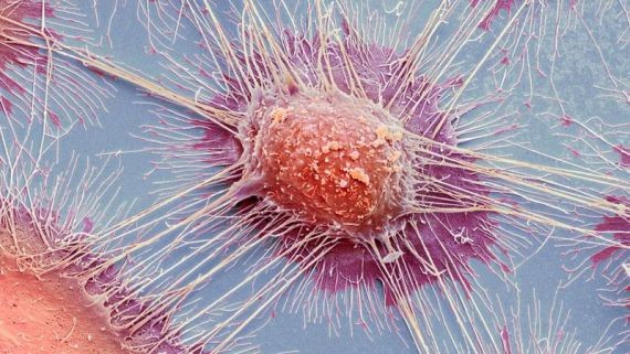 Un estudio del genoma del cáncer abre la posibilidad de detectarlo antes de que aparezca | Actualidad