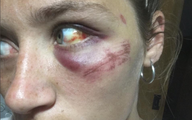 El calvario que vivió una joven que denunció a su ex novio: "Me convenció de que sus golpes tenían justificación" | Actualidad