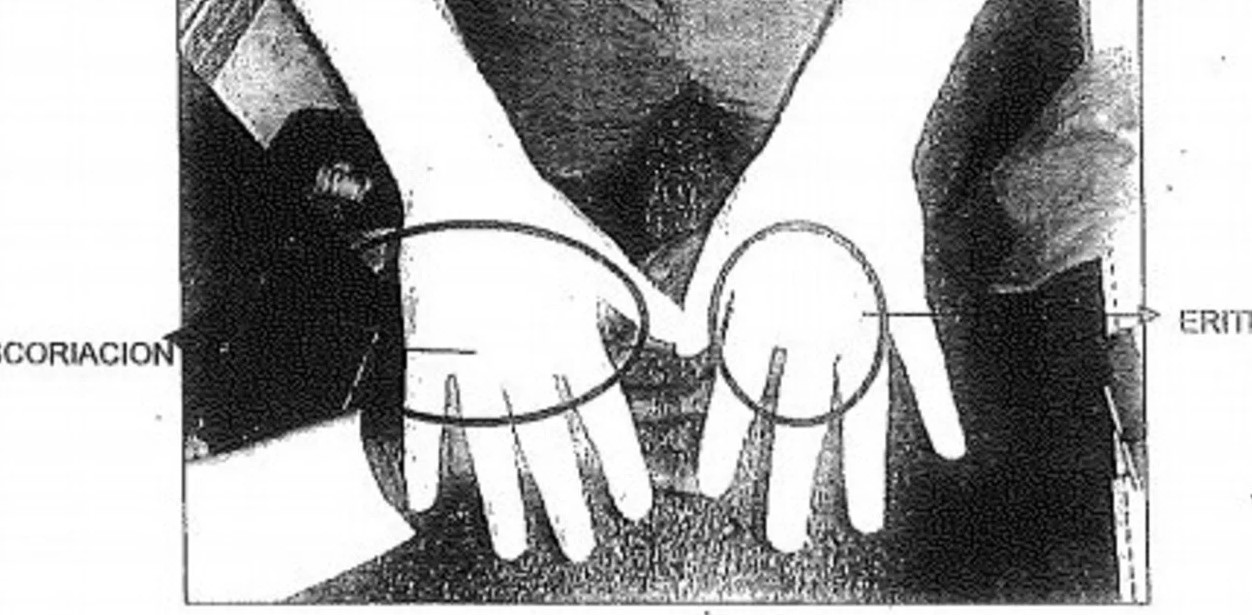 Todo los rugbiers tienen lesiones en manos y brazos compatibles con el ataque a Fernando | Actualidad