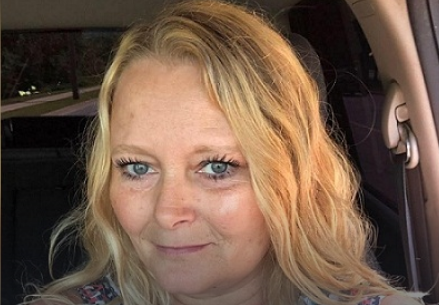 El calvario de una mujer tras un fallido tratamiento de cejas: "Me arruinó la cara" | Curiosidades