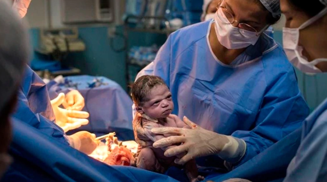 La foto una bebé que nació "enojada" y se convirtió en meme | Redes