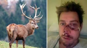 Un ciervo le arrancó la mitad de la cara a un cazador | Curiosidades
