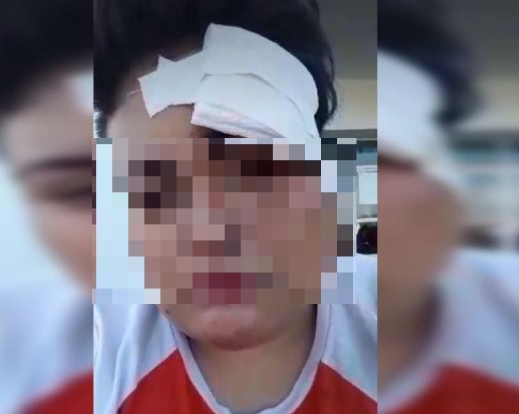 Ataque lesbofóbico: una mujer fue golpeada por 5 hombres por ser lesbiana | Actualidad