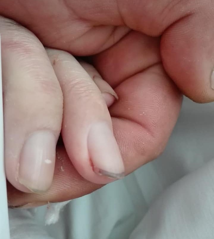 Agoniza un nene que recibió una bala perdida: "Mi hijo es tratado como un trapo sucio" | Actualidad