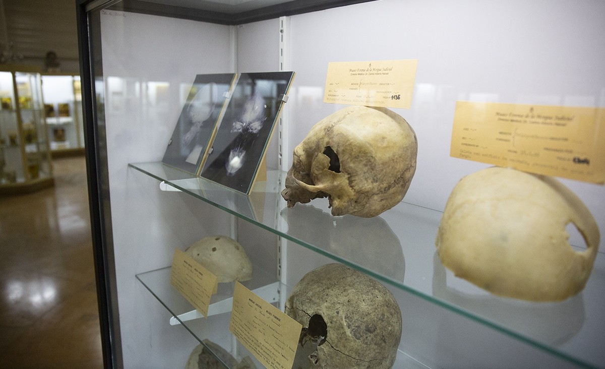 El museo que expone restos humanos | Actualidad