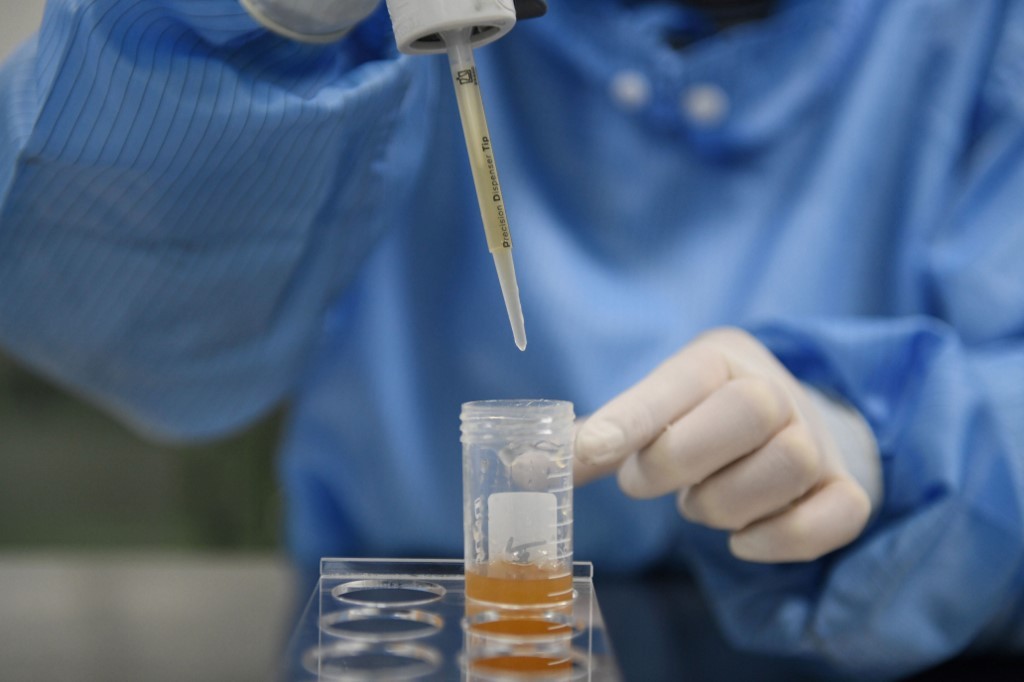 El laboratorio de biotecnología de Wuhan, en el centro de las sospechas por el origen del coronavirus | Internacionales