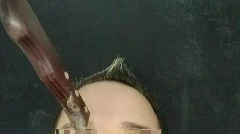 "Ingresó al hospital con el cuchillo clavado en la cara": operaron al colectivero asaltado | Actualidad