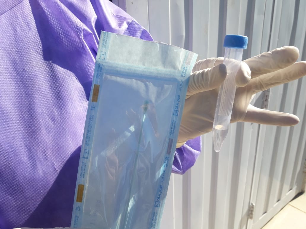 Adelanto: Cómo es y cuánto cuesta el hisopado en Córdoba | Córdoba