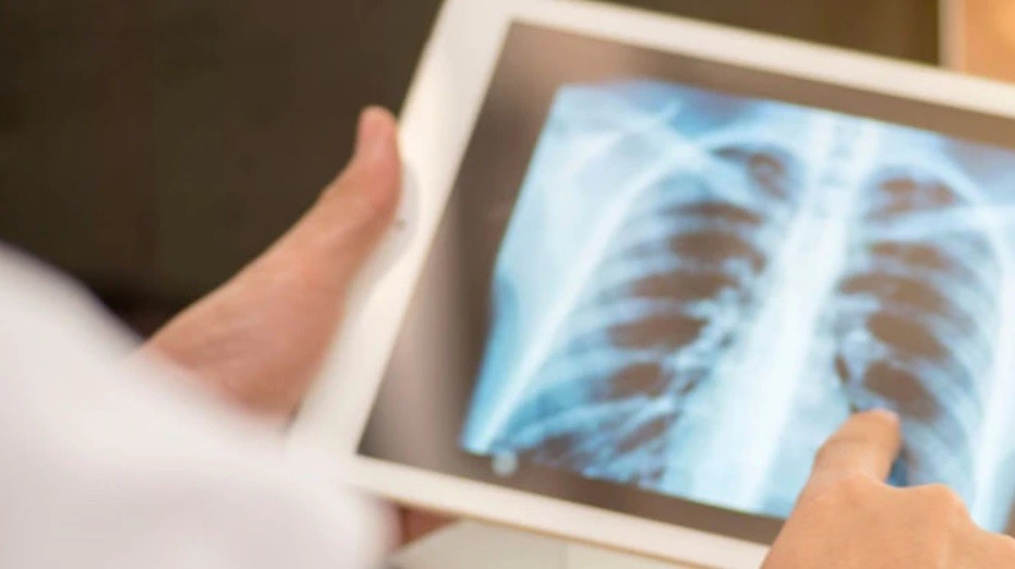 Alerta por el avance de otras enfermedades mortales a la sombra del coronavirus | Actualidad