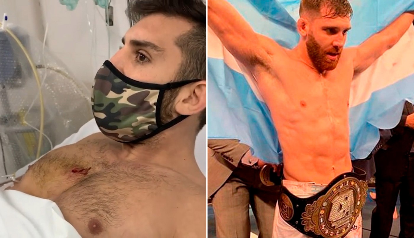 Buscan a los ladrones que balearon en el pecho a un peleador de MMA en Lanús | Actualidad