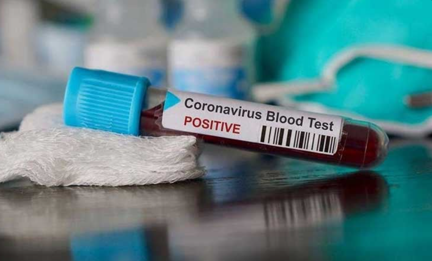 Oficial: no se confimaron casos ni hubo muertes por Covid-19 este domingo en Córdoba | Córdoba