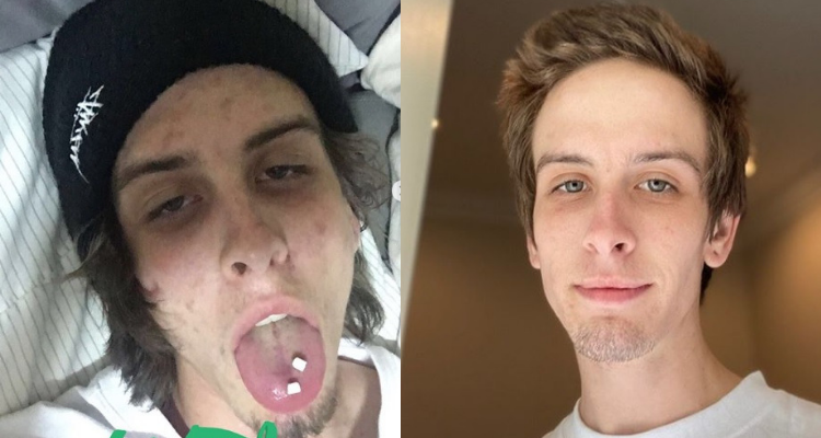 "Estoy vivo": el mensaje de un joven a 745 días de haber dejado las drogas | Curiosidades