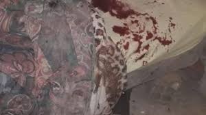 Le arrancó la oreja a su novia de un mordiscón | Actualidad