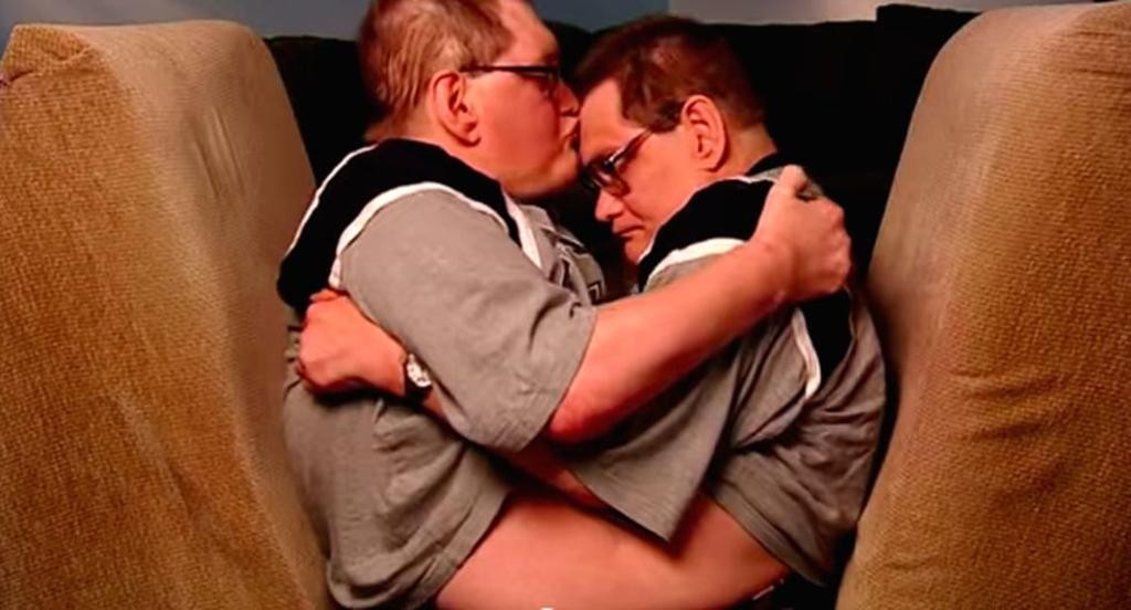 Murieron los hermanos siameses más longevos del mundo: vivieron 68 años con sus cuerpos unidos | Curiosidades