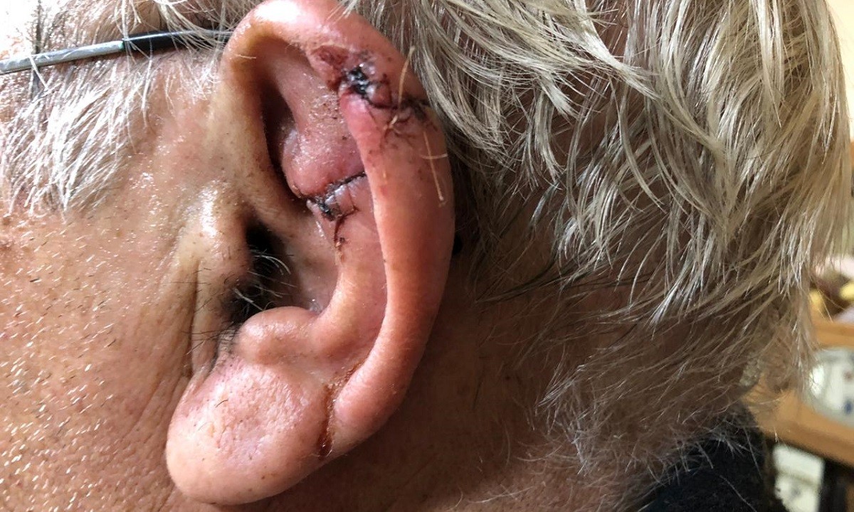 Por miedo al coronavirus y para no ir al hospital, se hizo coser la oreja por un veterinario | Actualidad
