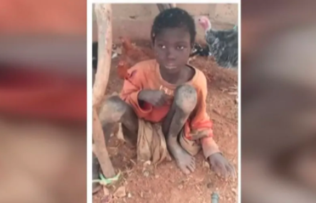 El nene que vivió dos años encadenado entre animales por tener epilepsia | Internacionales