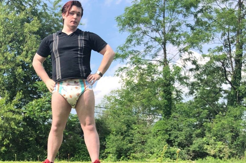 La historia del joven de 28 años que no consigue trabajo porque usa pañales | Actualidad