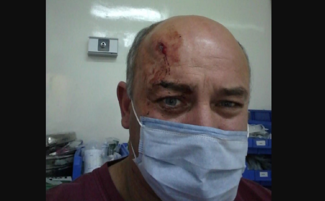 Ladrones balearon a un hombre en la cabeza y se salvó de milagro | Actualidad