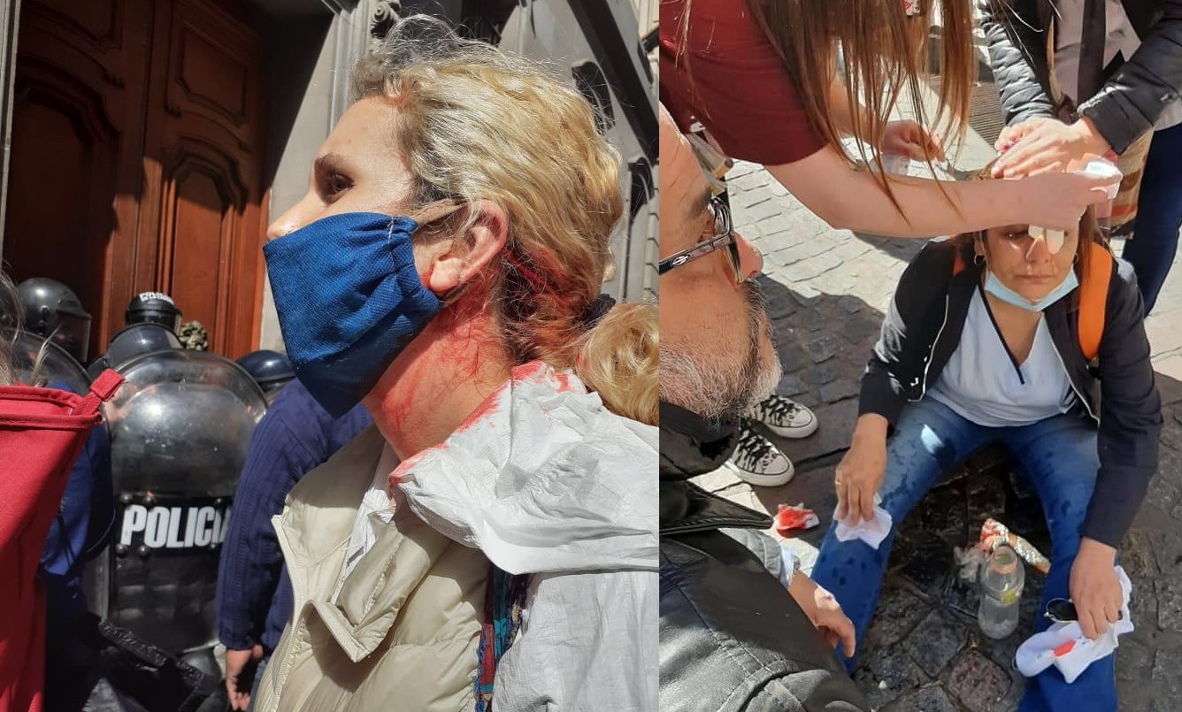 Buenos Aires: en el Día de la Sanidad una marcha de enfermeros terminó a los golpes frente a Legislatura porteña | Actualidad