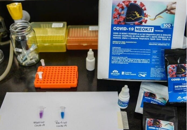 “Neokit-Covid-19”: de Argentina al mundo | Actualidad