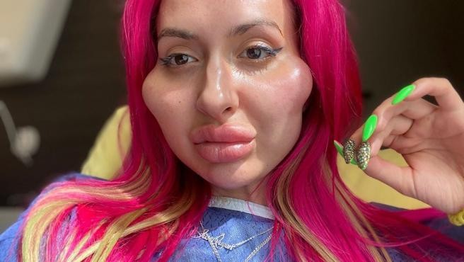 La historia de la mujer obsesionada por tener las mejillas más grandes del mundo | Curiosidades