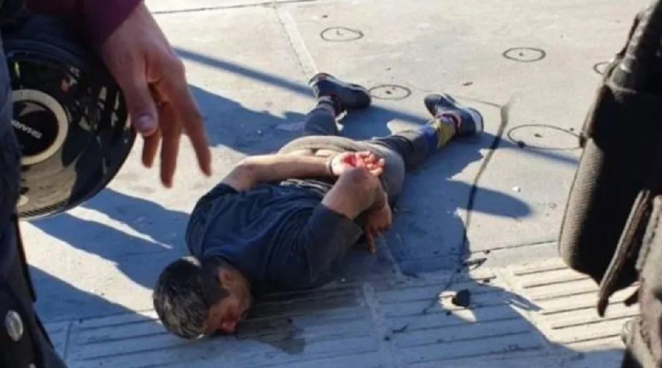 El "tirador de Retiro" recibió tres disparos, está grave y analizan amputarle una pierna | Actualidad