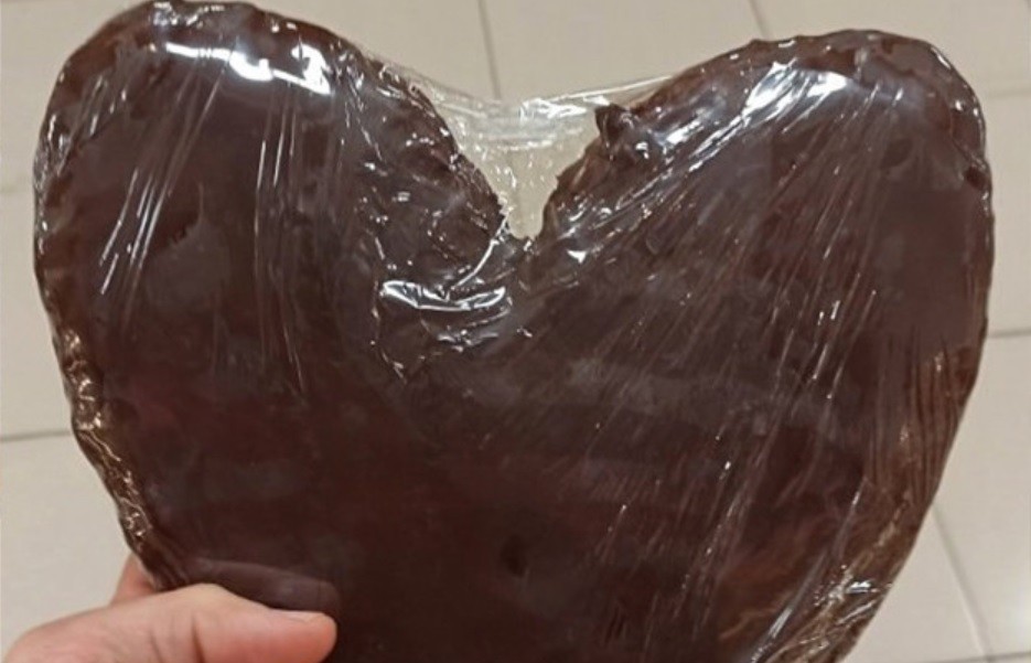 Nutricionista advierte sobre una factura que contiene 2300 kilocalorias | Actualidad