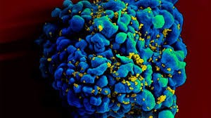 Alarma por el virus Chapare identificado en Bolivia: es similar al ébola | Internacionales