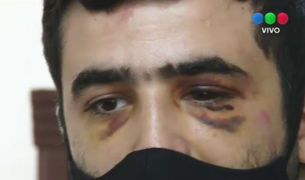 Detienen a cinco empleados municipales por agresiones a un comerciante y a un niño | Córdoba