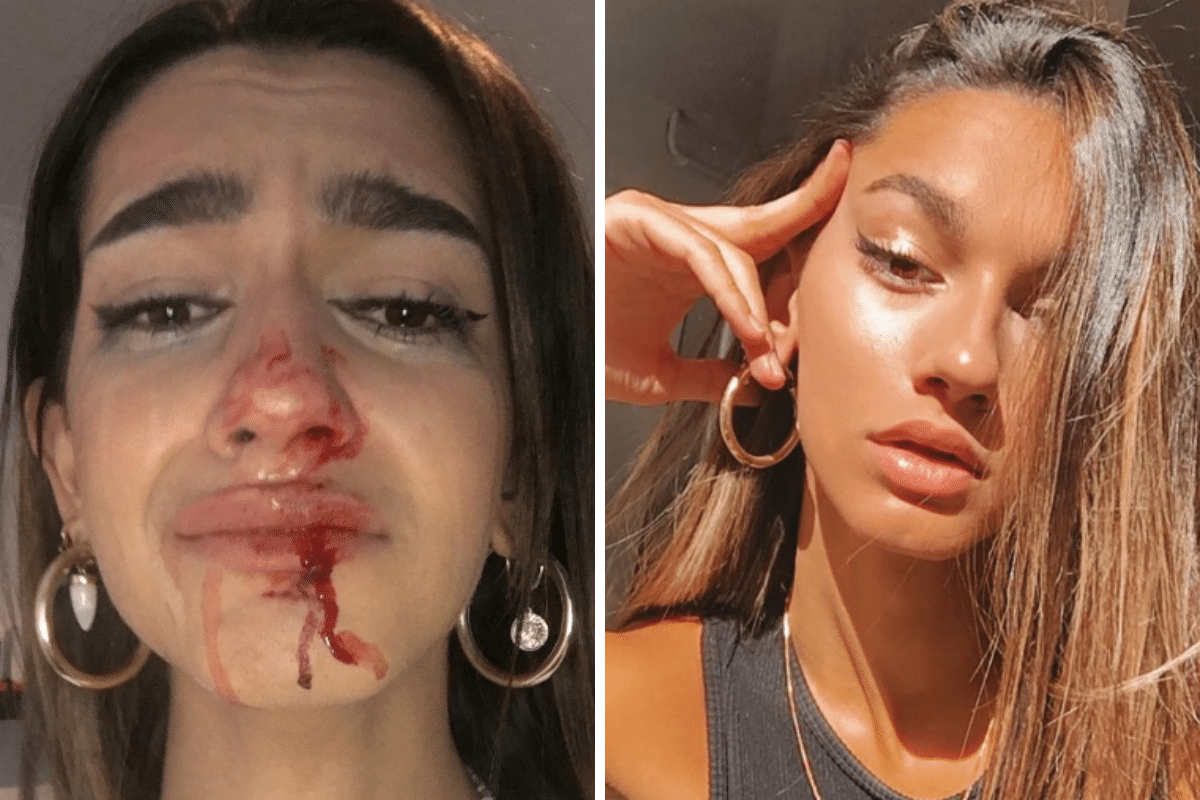Una influencer trans sufrió una brutal golpiza en la calle | Internacionales