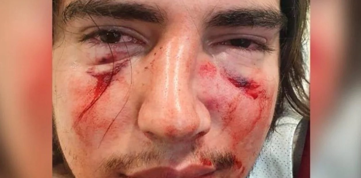 Rugbiers acusados por golpiza a un joven en Córdoba: el comunicado de la UAR | Deportes