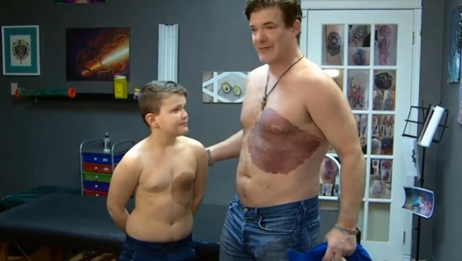 Video: el papá que se tatuó la mancha de nacimiento de su hijo para "hacerlo sentir bien" | Curiosidades