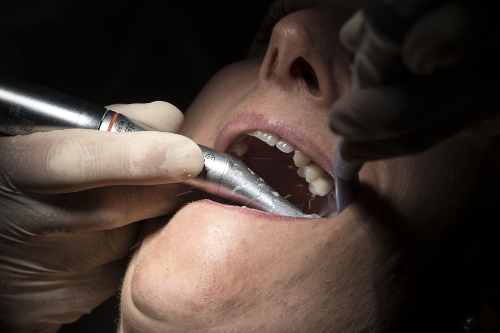 Acusan a un dentista de romper los dientes de pacientes para realizarles costosos procedimientos | Internacionales