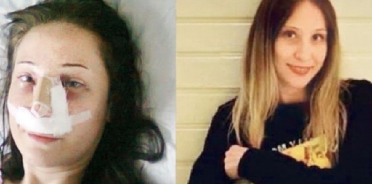 Fue al hospital para una cirugía estética en la nariz y terminó con las piernas amputadas | Internacionales