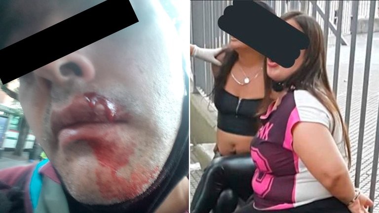 Un policía les pidió a dos mujeres que se pongan el barbijo y le respondieron con cascotazos | Actualidad