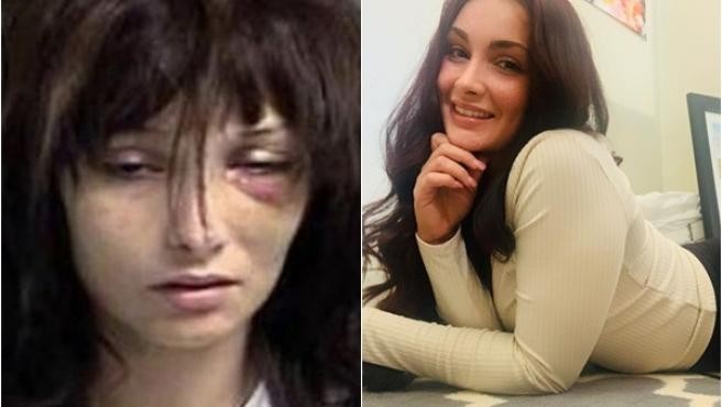 La joven que mostró en las redes su recuperación tras sus adicciones al crack y la heroína | Internacionales