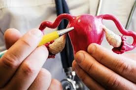 Más de 2.000 mujeres mueren por cáncer de cuello de útero causado por el VPH cada año en Argentina | Actualidad